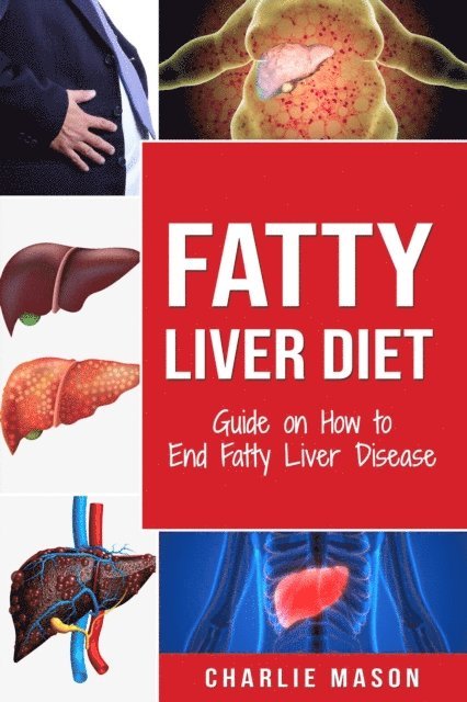 Charlie Mason - Fatty Liver Diet: Guide on How to End Fatty Liver Disease, E-bok