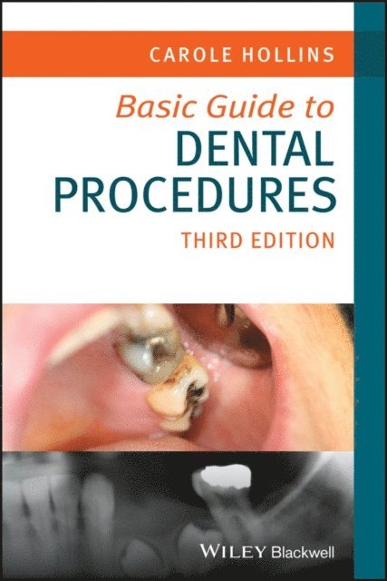 Carole Hollins - Basic Guide to Dental Procedures, E-bok
