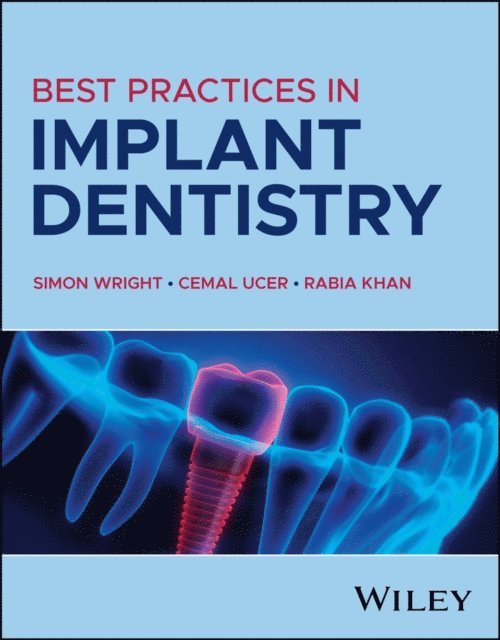 Rabia Khan, Cemal Ucer, Simon Wright - Best Practices in Implant Dentistry, E-bok