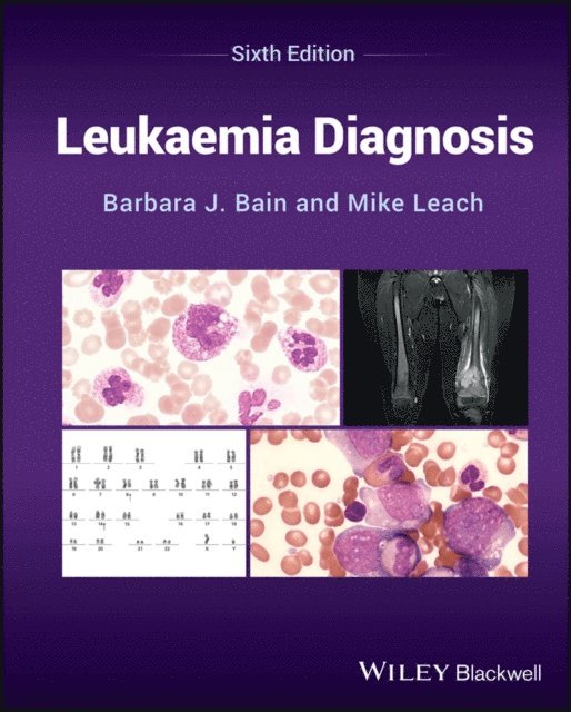 Mike Leach, Barbara J. Bain - Leukaemia Diagnosis, E-bok