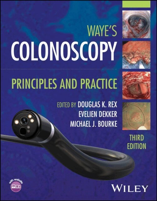 Michael J. Bourke, Evelien Dekker, Douglas K. Rex - Waye's Colonoscopy, E-bok