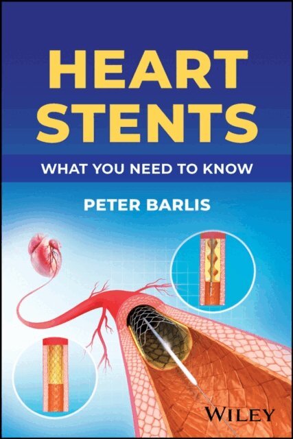 Peter Barlis - Heart Stents, E-bok