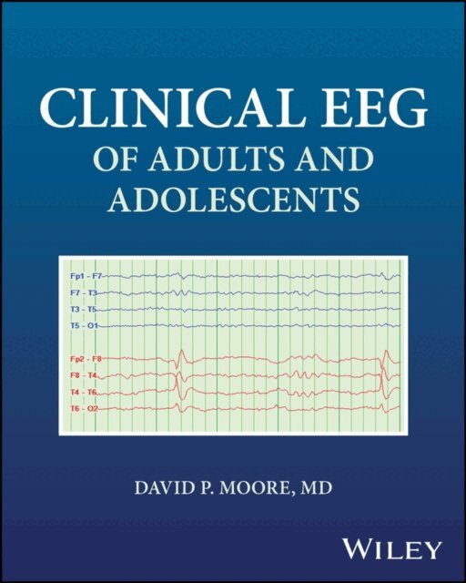 David P. Moore - Clinical EEG of Adults and Adolescents, E-bok