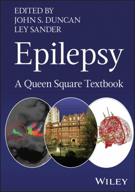 Ley Sander, John S. Duncan - Epilepsy, E-bok