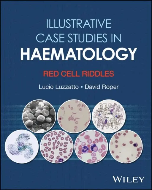 David R. Roper, Lucio Luzzatto - Illustrative Case Studies in Haematology, E-bok. Tillgänglighet: Lägg i varukorg