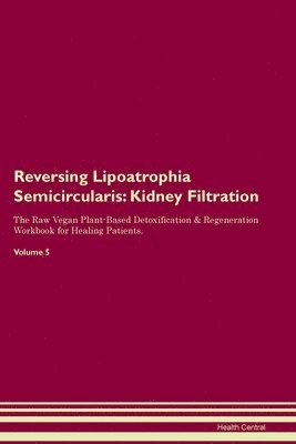 Health Central - Reversing Lipoatrophia Semicircularis, Häftad. Tillgänglighet: Lägg i varukorg