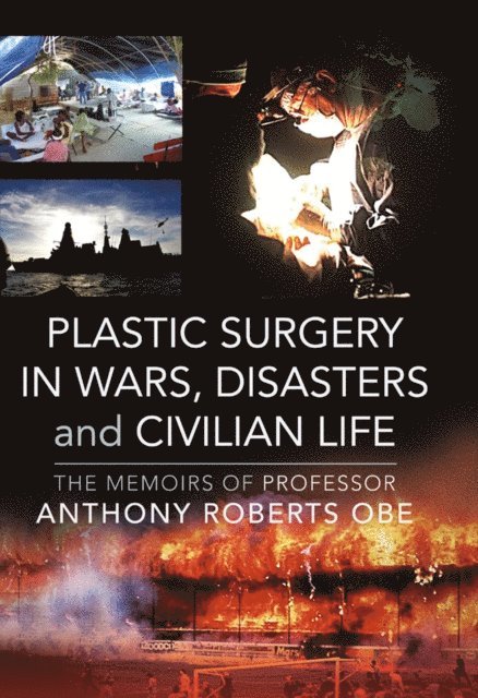 Anthony Roberts - Plastic Surgery in Wars, Disasters and Civilian Life, E-bok