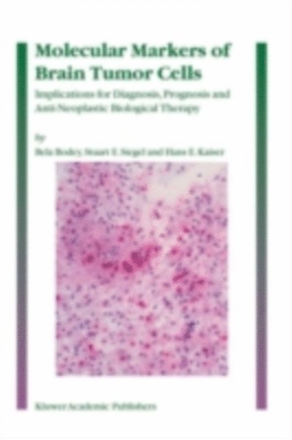 Hans E. Kaiser, Stuart E. Siegel, Bela Bodey - Molecular Markers of Brain Tumor Cells, E-bok