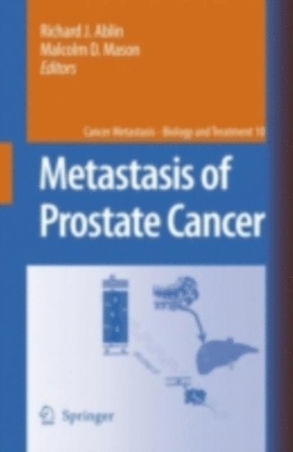 Malcolm D. Mason, Richard J. Ablin - Metastasis of Prostate Cancer, E-bok
