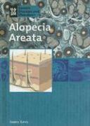 Janey Levy - Alopecia Areata, Inbunden. Tillgänglighet: Lägg i varukorg