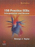 150 Practice ECGs av George J Taylor, George J Taylor