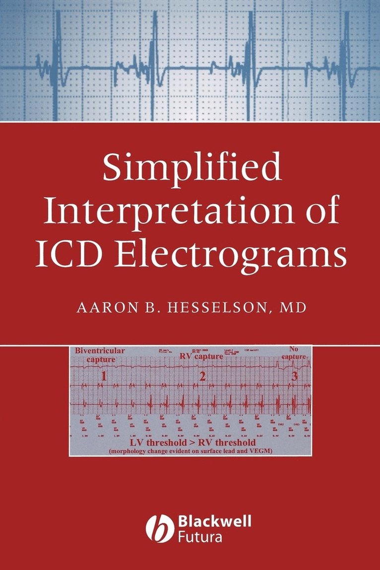 Aaron B. Hesselson - Simplified Interpretation of ICD Electrograms, Häftad. Tillgänglighet: Lägg i varukorg