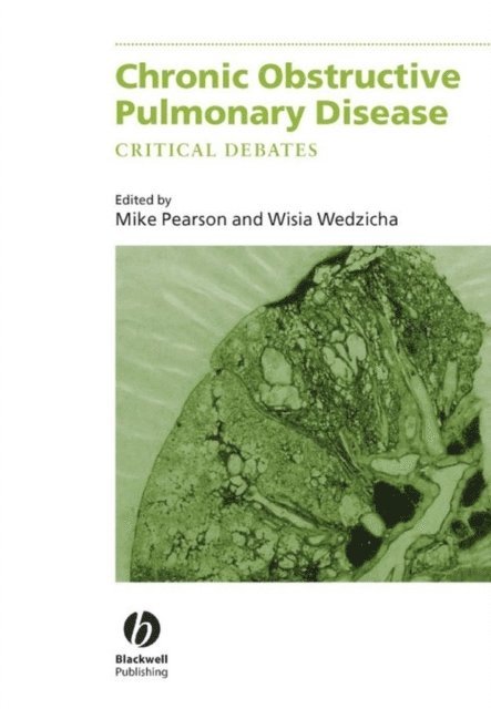 Jadwiga Wedzicha, Michael Pearson - Chronic Obstructive Pulmonary Disease, E-bok