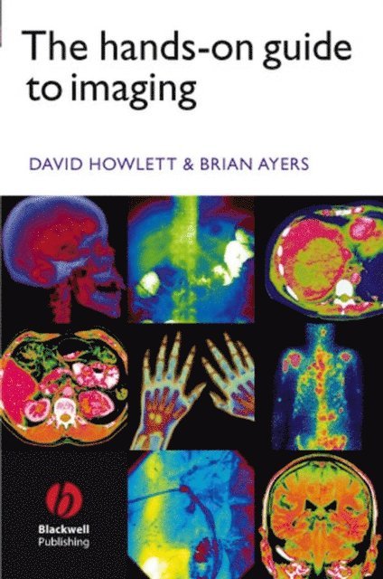Brian Ayers, David C. Howlett - Hands-on Guide to Imaging, E-bok