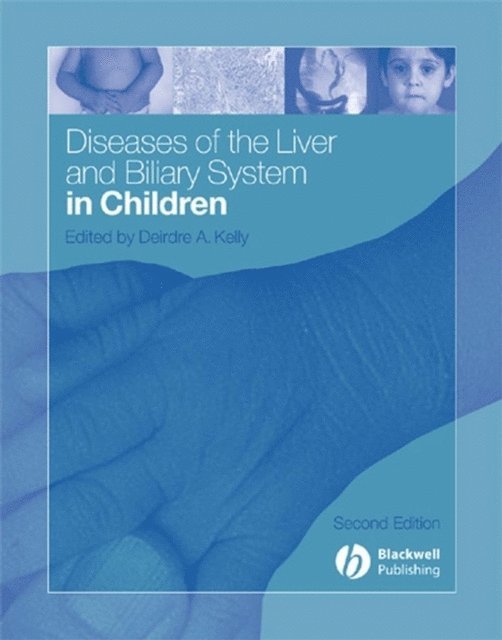Deirdre A. Kelly - Diseases of the Liver and Biliary System in Children, E-bok
