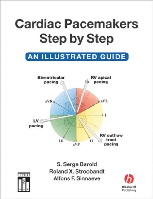 Alfons F. Sinnaeve, Roland X. Stroobandt, S. Serge Barold - Cardiac Pacemakers Step by Step, E-bok