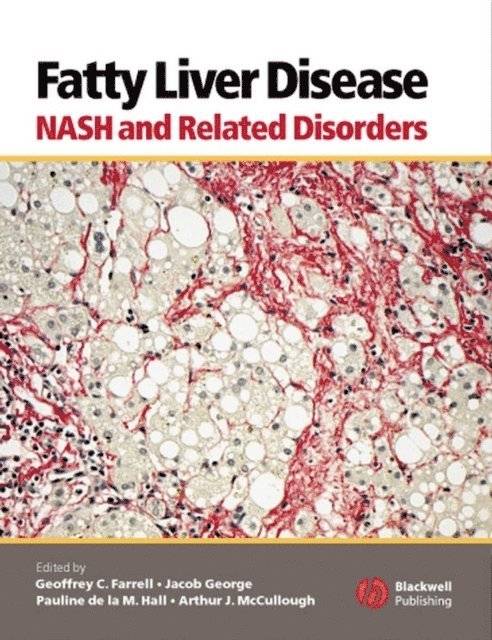 Arthur J. McCullough, Pauline de la M. Hall, Jacob George, Geoffrey C. Farrell - Fatty Liver Disease, E-bok