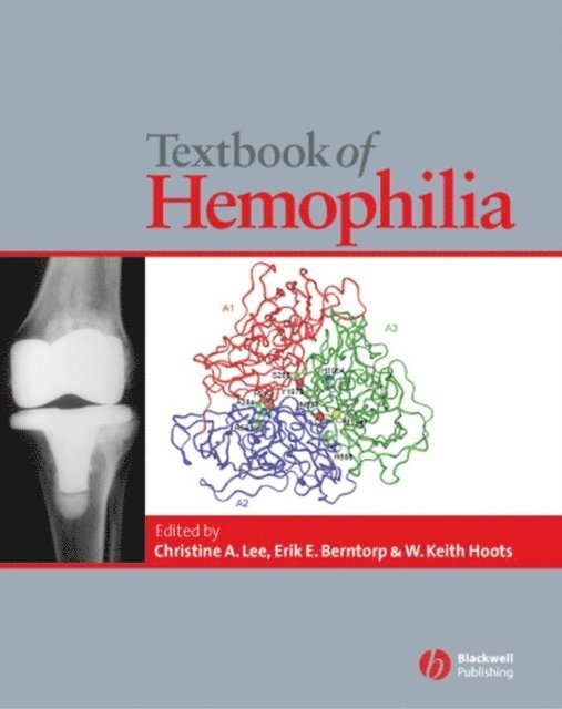 W. Keith Hoots, Erik E. Berntorp, Christine A. Lee - Textbook of Hemophilia, E-bok