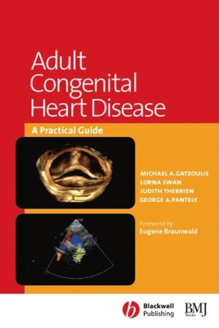 George A. Pantely, Judith Therrien, Lorna Swan, Michael A. Gatzoulis - Adult Congenital Heart Disease, E-bok