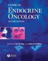 Clinical Endocrine Oncology av Ian D Hay, John A H Wass, Ian D Hay, John A H Wass, Ian D Hay
