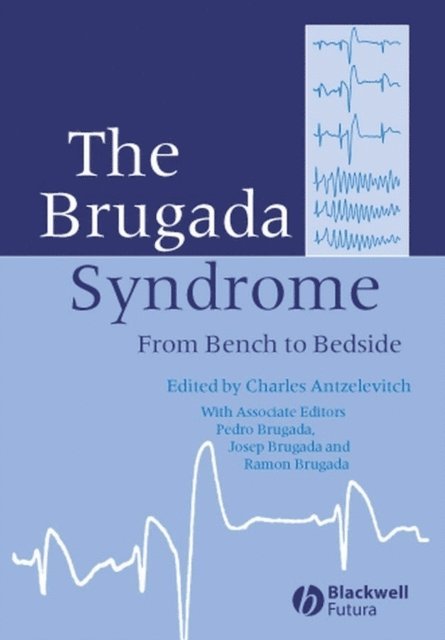 Charles Antzelevitch - Brugada Syndrome, E-bok