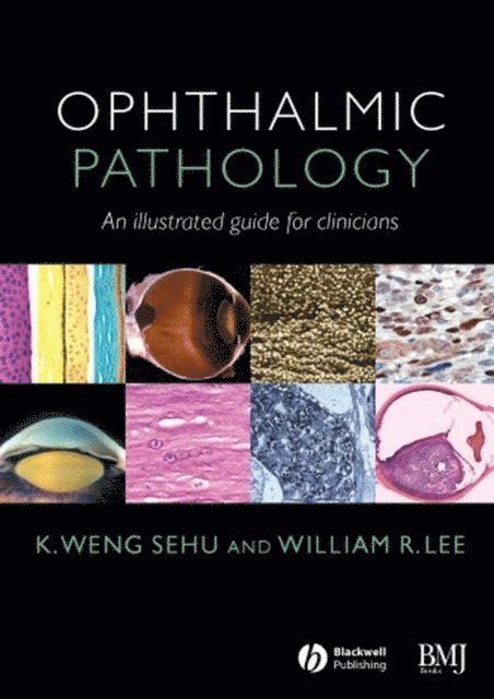 William R. Lee, K. Weng Sehu - Ophthalmic Pathology, E-bok