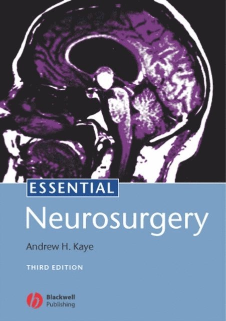 Andrew H. Kaye - Essential Neurosurgery, E-bok