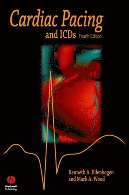 Mark A. Wood, Kenneth A. Ellenbogen - Cardiac Pacing and ICDs, E-bok