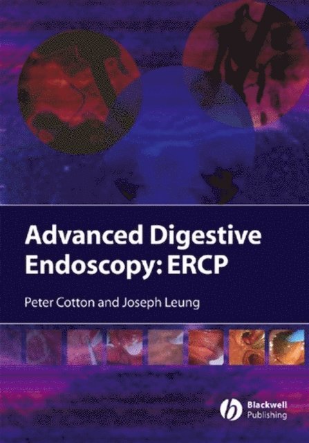 Joseph W. Leung, Peter B. Cotton - Advanced Digestive Endoscopy, E-bok