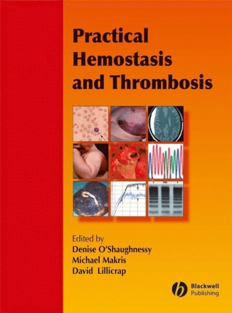 David Lillicrap, Michael Makris, Denise O'Shaughnessy - Practical Hemostasis and Thrombosis, E-bok
