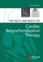 Nuts and Bolts of Cardiac Resynchronization Therapy