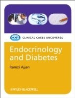 Endocrinology and Diabetes