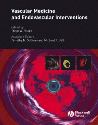 Thom W. Rooke - Vascular Medicine and Endovascular Interventions, Inbunden. Tillgänglighet: Lägg i varukorg