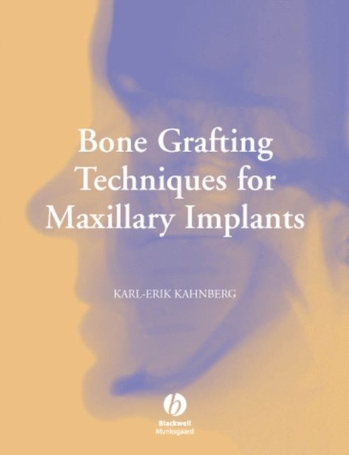 Karl-Erik Kahnberg - Bone Grafting Techniques for Maxillary Implants, E-bok