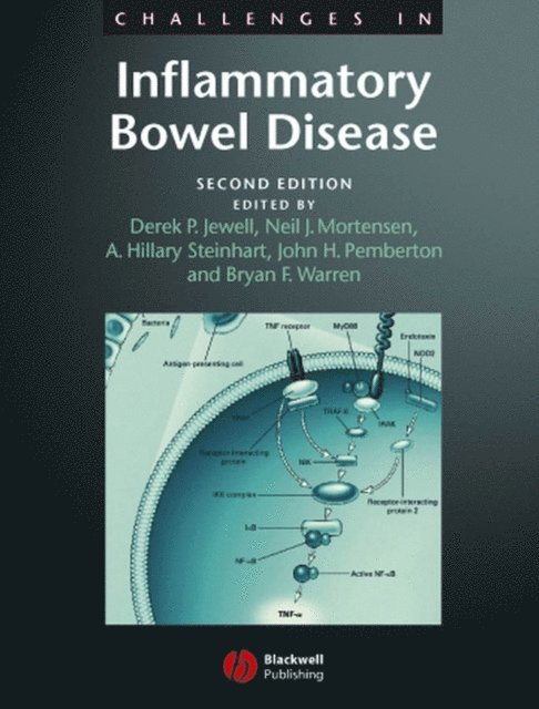 Bryan F. Warren, John A. Pemberton, A. Hillary Steinhart, Neil J. Mortensen, Derek P. Jewell - Challenges in Inflammatory Bowel Disease, E-bok