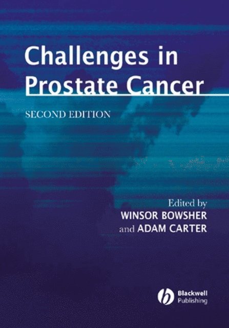 Adam Carter, Winsor Bowsher - Challenges in Prostate Cancer, E-bok