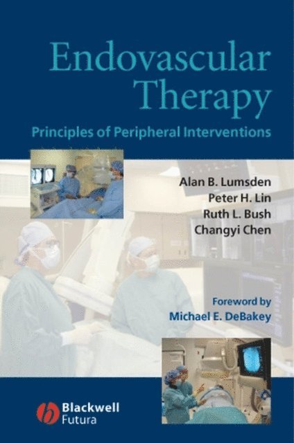 Changyi Chen, MD Ruth L. Bush, Peter H. Lin, Alan B. Lumsden - Endovascular Therapy, E-bok