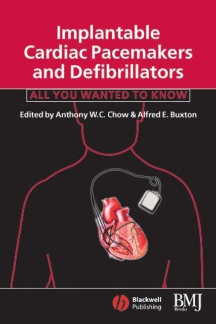 Alfred E Buxton, Anthony W C Chow - Implantable Cardiac Pacemakers and Defibrillators, E-bok