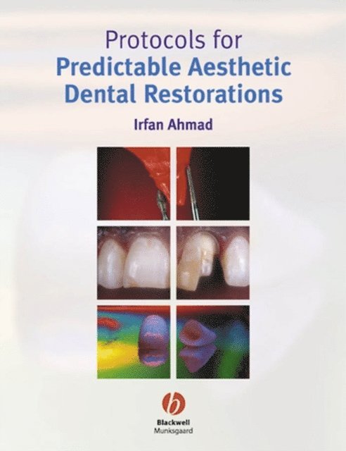 Irfan Ahmad - Protocols for Predictable Aesthetic Dental Restorations, E-bok