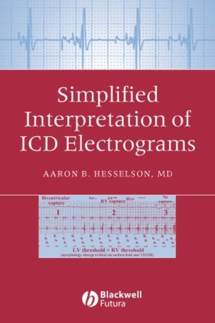 Aaron B. Hesselson - Simplified Interpretation of ICD Electrograms, E-bok. Tillgänglighet: Lägg i varukorg