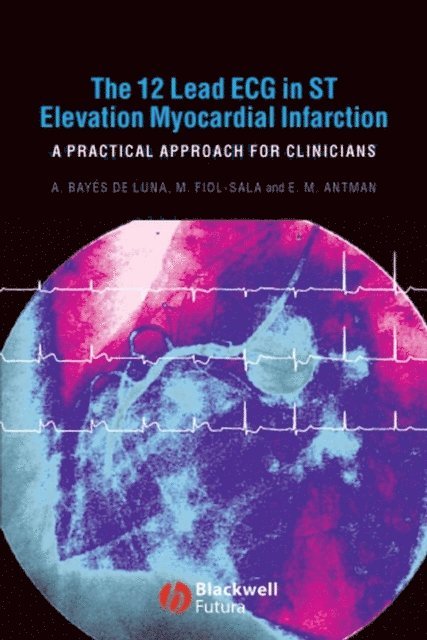 Elliot M. Antman, Miquel Fiol-Sala, Antoni Bay s de Luna - 12 Lead ECG in ST Elevation Myocardial Infarction, E-bok