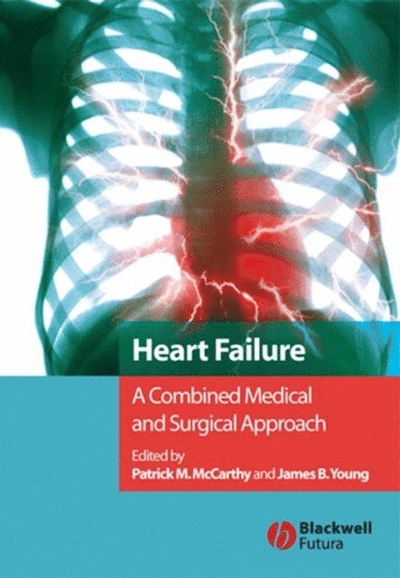 James B. Young, Patrick M. McCarthy - Heart Failure, E-bok