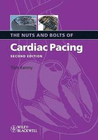 The Nuts and Bolts of Cardiac Pacing