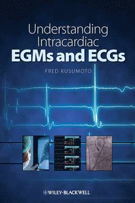 Fred M. Kusumoto - Understanding Intracardiac EGMs and ECGs, Häftad. Tillgänglighet: Lägg i varukorg