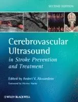 Andrei V. Alexandrov - Cerebrovascular Ultrasound in Stroke Prevention and Treatment, Inbunden. Tillgänglighet: Lägg i varukorg