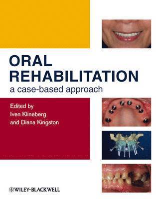 Iven Klineberg, Diana Kingston - Oral Rehabilitation, Inbunden. Tillgänglighet: Tillfälligt slut