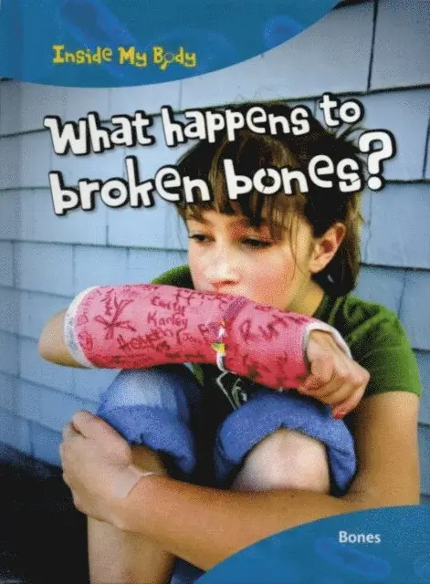 Carol Ballard - What Happens to Broken Bones?, E-bok. Tillgänglighet: Lägg i varukorg