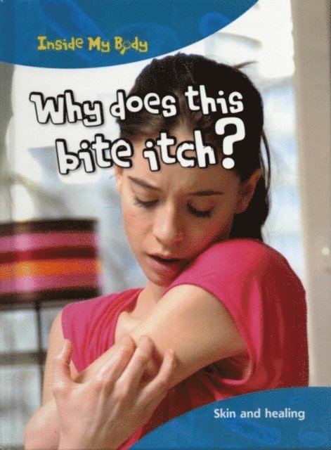 Steve Parker - Why does this Bite Itch?, E-bok