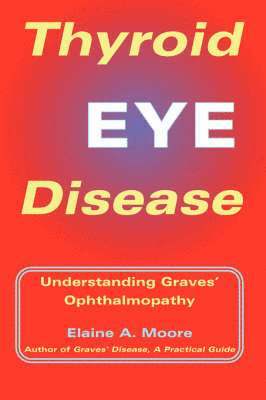 Elaine Moore - Thyroid Eye Disease, Häftad. Tillgänglighet: Lägg i varukorg