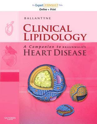 Christie M. Ballantyne - Clinical Lipidology: A Companion to Braunwald's "Heart Disease", Övrigt